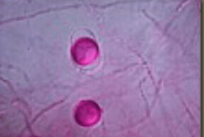 Tiloom - Otimize o seu solo com análises microbiológicas avançadas - Capturas de ecrã 23/08/2016 15:50:27 Screenshots_2016-08-23-15-50-27
