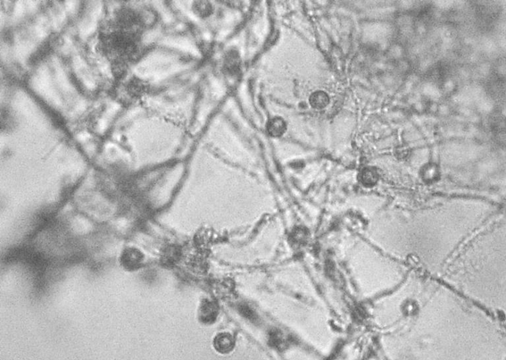 Tiloom - Lawn Disease Detection IV: Pythium - image 22 Tiloom - Lawn Disease Detection IV: Pythium - image 22